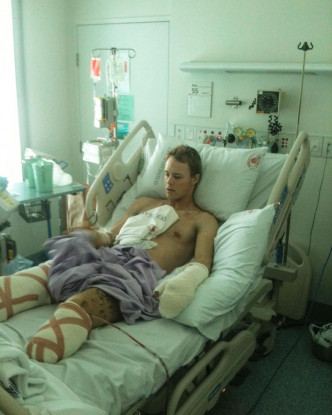 澳洲殘奧選手麥格瑞斯在阿富汗服役時雙腿遭炸斷。網圖
