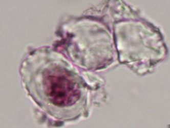 尾羽龍腿骨軟骨細胞的顯微照片。網上圖片