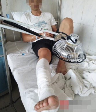 男子被菜刀砍伤右小腿，右胫前肌腱断裂。网图