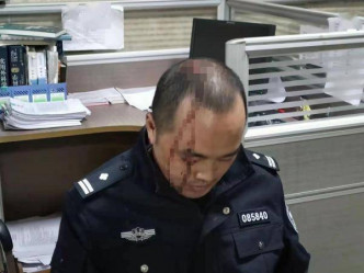 到場調查的警員被打傷頭部。（網上圖片）