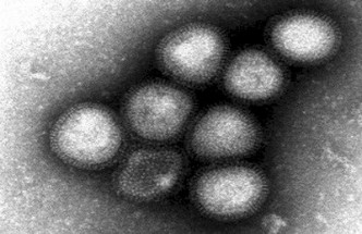 有专家担心，病毒已突变成新型流感病毒，有可能引发全球流行病。