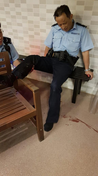 一名男警遭野豬咬傷警員右小腿及腰部。讀者提供
