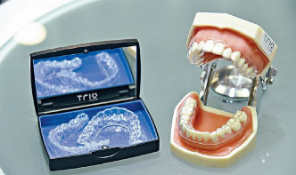不少人為了改善牙齒美觀程度而接受矯齒療程，過程中也需要牙醫檢查及協助。