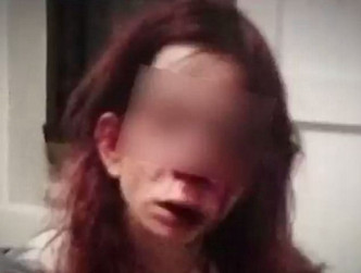 17岁智障女遭围殴迫吞玻璃。