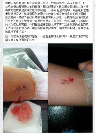 台灣男童手臂被剪開2厘米。網上圖片