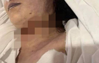 哈基米身首虽被驳回，但颈部亦有一道明显的切痕。互联网图片