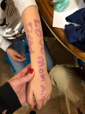 女童在手臂上写下「爸妈，我爱你们」的字句。女童母亲FB图片