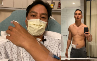 吳彥祖去年治療盲腸炎後消瘦了18磅（右），沒想到日前復發，幸做完手術已回家休養。