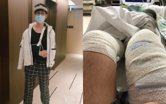 林奕匡因為失足入院，留醫幾日終於出院。