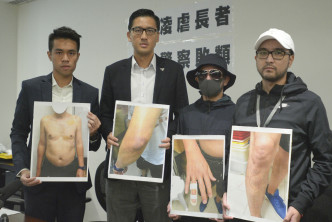 社區主任郭㙟豐(左一)及立法會議員林卓廷(左二)展示事主傷勢 。 資料圖片