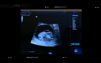 Leanna展示胎兒超聲波。
