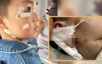 瘋狗症︱河南3歲男童遭咬死  當局調查疫苗失敗事件