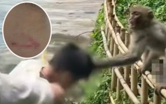 貴州7歲童舉中指遭馬騮圍毆   公園賠償這東西