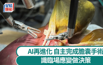 AI做手術｜機械人首「自主執刀」切膽囊  準確率100％識決策
