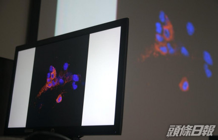袁國勇的團隊成功在臨床標本中分離出Omicron變種病毒株。