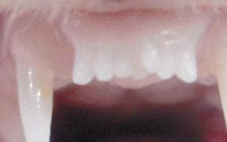 日新創公司研發「長牙藥」 9月臨床試驗