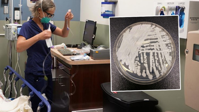 美国医疗机构爆发耳念珠菌感染，已蔓延逾半州份。AP
