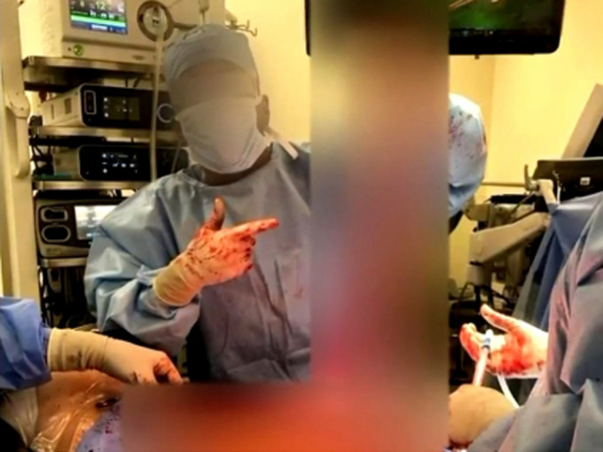 這些缺德醫生會拿病人的器官比賽「誰的病人器官最長」。(網圖)
