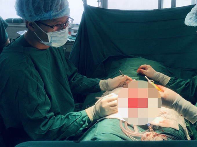 醫生分享駁回生殖器手術個案。