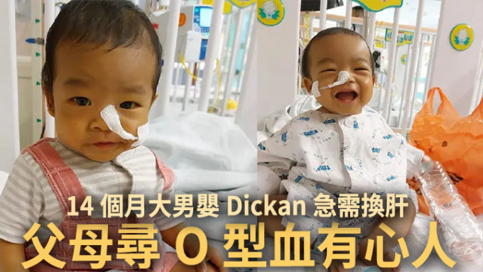 14個月的Dickan正急需換肝，其父母希望O型血人士伸出援手。
