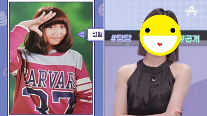 26歲韓女全身大執近40次，僅因一句全臉只有雙耳天然。