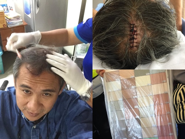 泰國一名歌手兼作家被一塊重約4公斤的地磚樣品擊中頭部。網圖