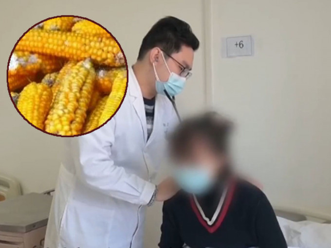 23岁女子因接触霉变玉米，咳喘一个多月不止，医生指其肺部长满真菌。网图