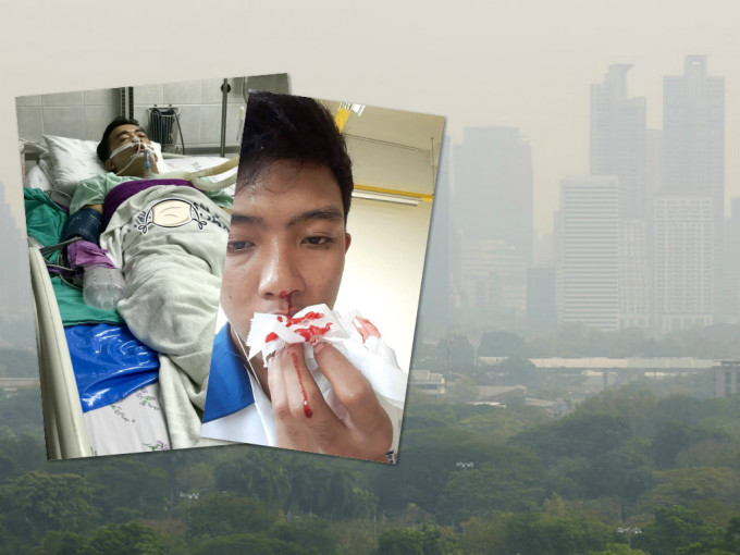 泰國男子在空氣污染下幾乎過敏死亡。網上圖片