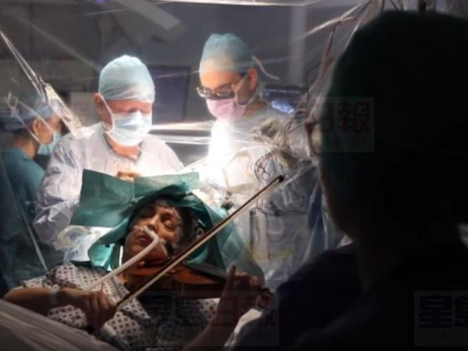 英國國王學院醫院一名病人，日前一邊進行開顱腦瘤移除手術，一邊用小提琴演奏馬勒和蓋希文的音樂，好確保手術沒有傷到左手細部動作區域。