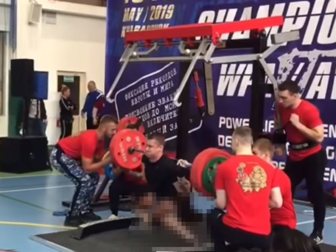 俄羅斯一名舉重選手嘗試舉起重達250公斤的槓鈴時，因承受不住重量，右腿被「咯」一聲折斷。　影片截圖