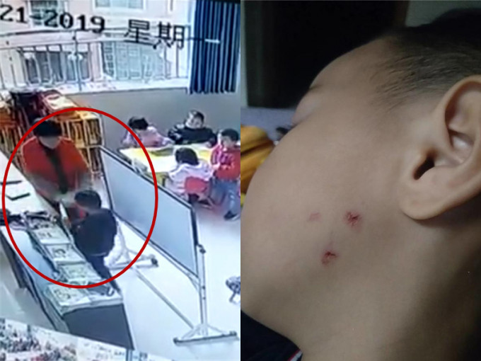 贵州有幼稚园教师涉嫌虐打学生，被停职及行拘。（网图）