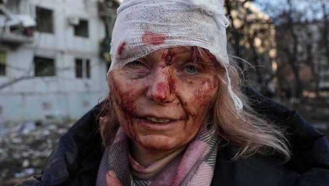 乌克兰妇女照片诉说战争残酷。网图