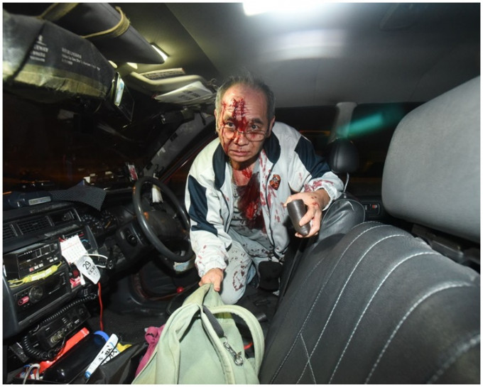 其中一名受伤的士司机血流披面。丁志雄摄