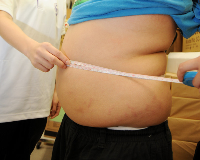 肥胖是罹患肝癌元凶之一。示意图片