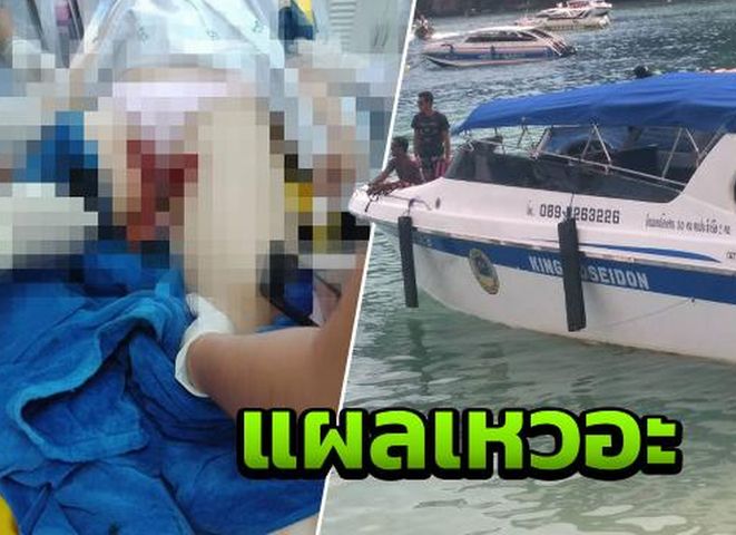 一名39岁中国女游客上周六在泰国PP岛附近的Pilae海湾旅玩时，从船尾下水后，被船桨割伤。网图