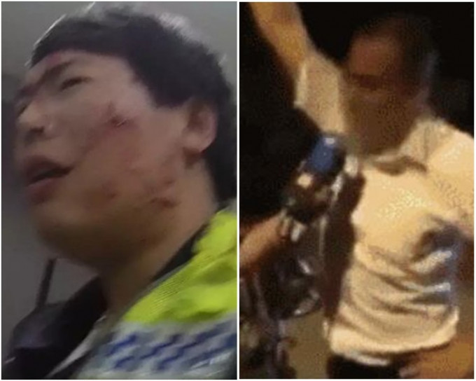 交警的脸部(左)被孙男(右)抓伤。网图