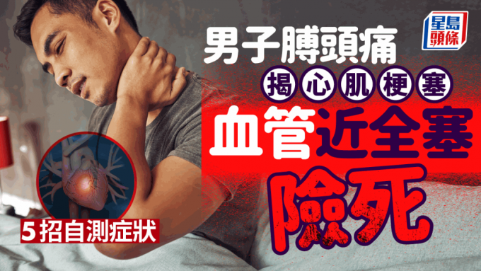 心肌梗塞症狀｜男子肩痛揭心肌梗塞 血管近100%堵塞險死 醫生教5招自測
