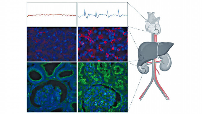 （上至下）左邊為死豬的心電圖、肝細胞、腎臟細胞影像；右邊為使用了OrganEx技術的影像。