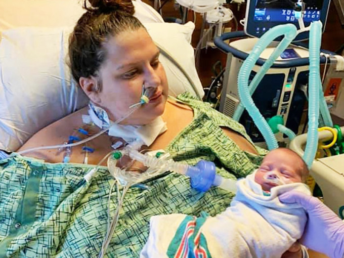美國一名30歲確診孕婦早前病危住院，一度陷入昏迷20天，怎料再次醒來時發現孩子已出生。網圖