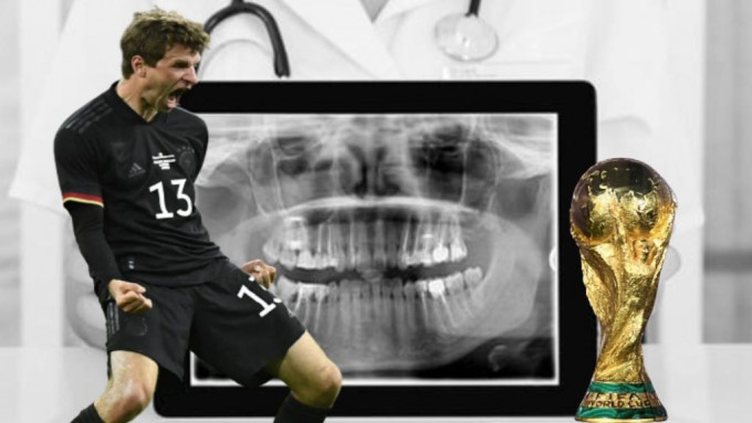 德国聘请牙医负责球员口腔健康，提升战力。