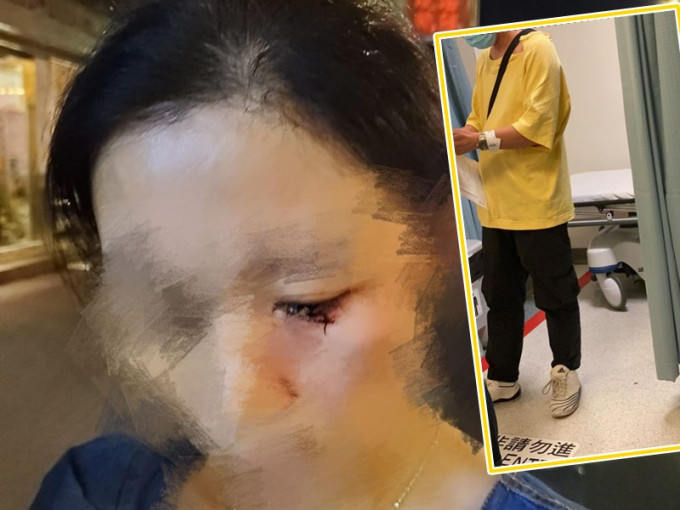 冰室老板夫妇遇袭受伤。区议员张秀贤fb图片