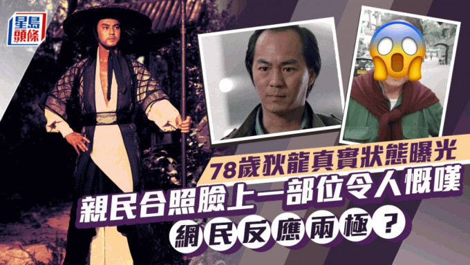 78歲狄龍真實狀態曝光！親民與Fans合照臉上一部位令人慨嘆 網民反應兩極？