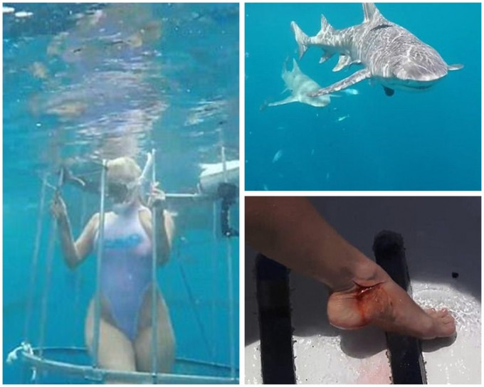 女模卡瓦利遭一条柠檬鲨攻击。网图