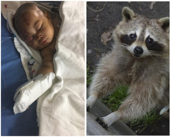 有浣熊偷潛入民居將4月大女嬰咬傷。