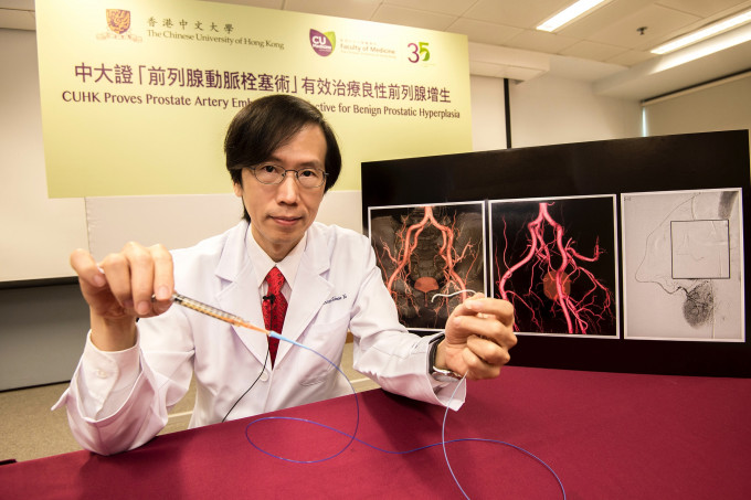 余俊豪教授領導的研究證實「前列腺動脈栓塞術」有效治療良性前列腺增生，成功率達九成。