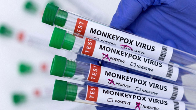 衞健委公布最新猴痘防治指引，来自有爆发地区者需接受筛检。路透社资料图片