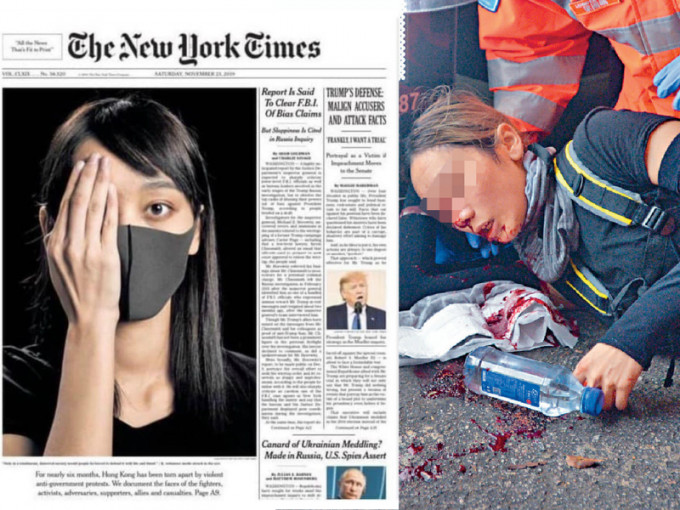 右眼受傷女子登上《紐時》封面。紐約時報；資料圖片