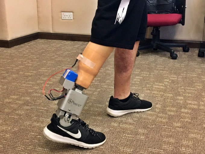 動力型膝下義肢。