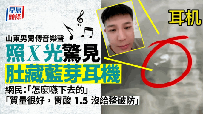 山东男上传影片表示胃中传来音乐声，因睡觉时误吞蓝牙耳机。