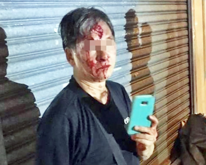 遇袭男子血流披脸。fb「香港人连侬墙」Machi Ho‎图片